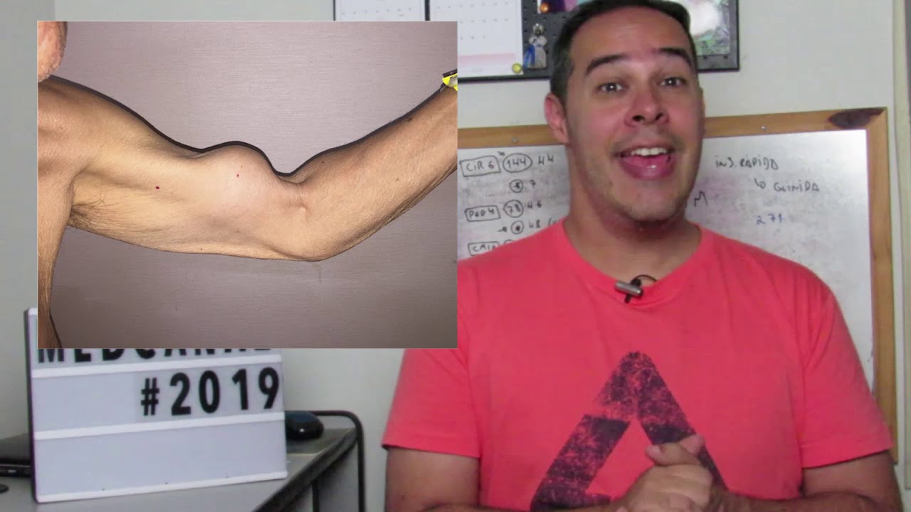 Sinal do Popeye | Medicina e Arte