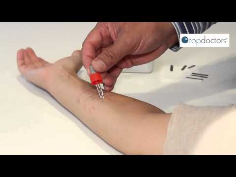 Allergies in children: how to detect them