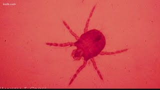 Chigger bites spiking this time of year