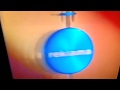 Tvn Reklama 2000