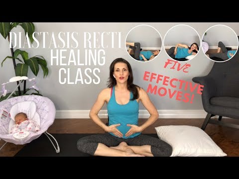 Best Exercises for Diastasis Recti Postpartum Ab Workout