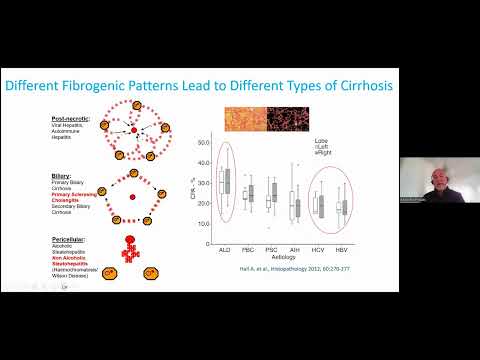 "Reversibility of cirrhosis: reality or myth?” - Prof Massimo Pinzani