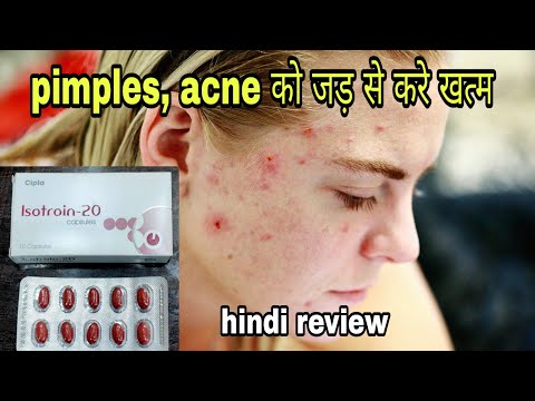 Isotroin 20 capsule hindi review | डॉक्टर क्यों मानते है Istroin 20 को acne की best दवा