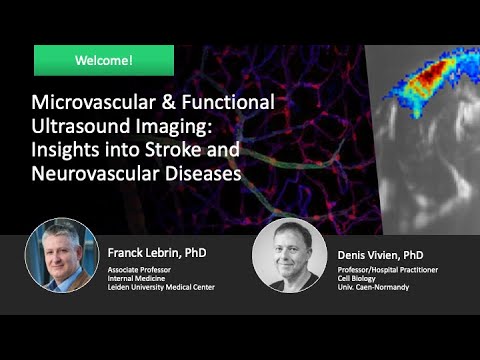 Microvascular & Functional Ultrasound Imaging: Insights into Stroke and Neurovascular Diseases