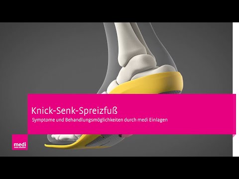 Plattfuß – Knick-Senk-Spreizfuß: Behandlung mit orthopädischen Einlagen aus Carbon von medi