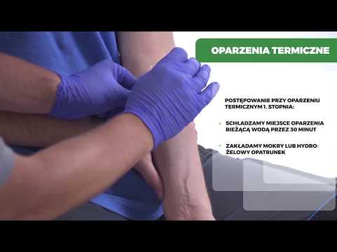 OPARZENIA TERMICZNE - PIERWSZA POMOC PRZEDMEDYCZNA
