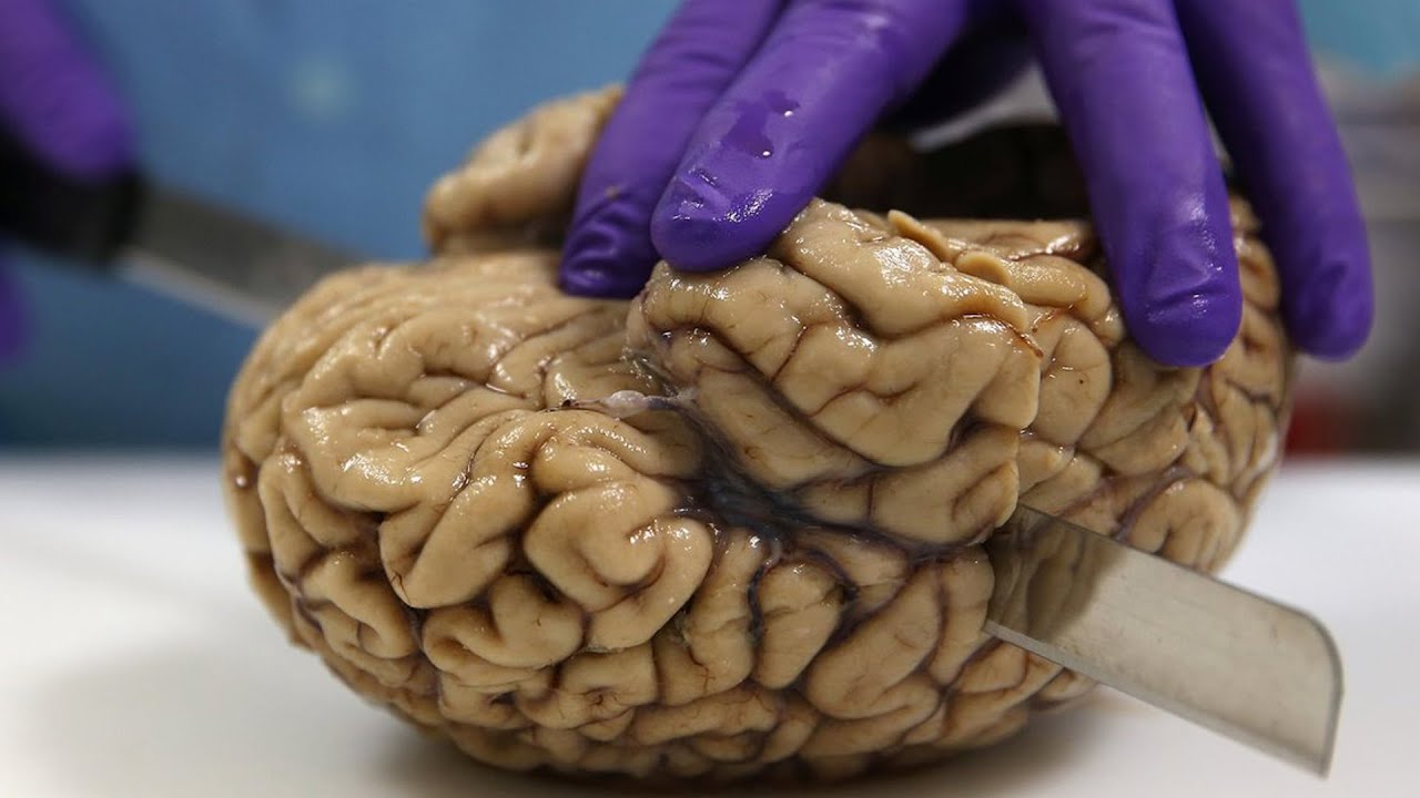 Why Do Intelligent People do Stupid Things?