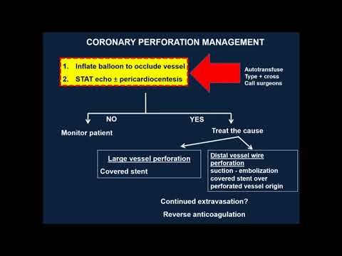 COMPLICATION BOOTCAMP: MY WORST COMPLICATION - Yader Sandoval, MD