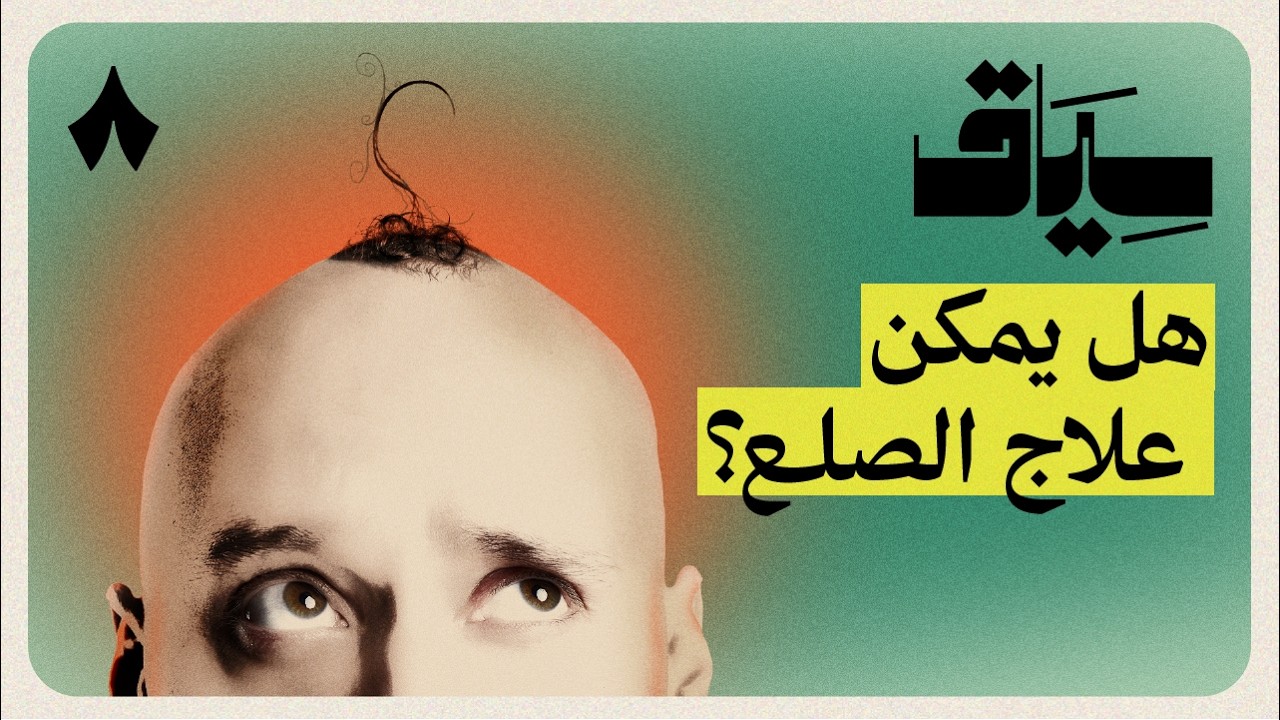 الصلع | سياق