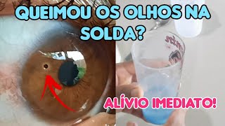 ALIVIO IMEDIATO PARA QUEIMADURA DE SOLDA NOS OLHOS | Elizabeth Aurea