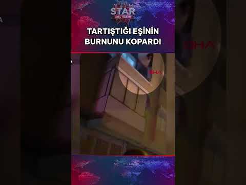 Çocuklarının Gözü Önünde Akılalmaz Vahşet! Eşinin Burnunu Isırıp Kopardı #shorts