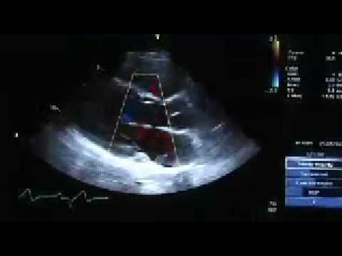 Insidermedicine in 60 - February 10, 2009