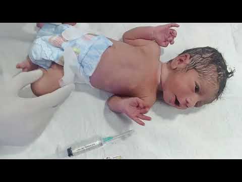First Time IV Line Insertion in a Critical Newborn Baby | NICU Procedure Step by Step