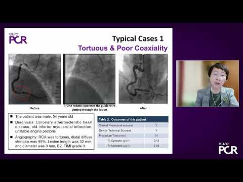 Embrace the innovation in PCI and TAVR - EuroPCR 2022