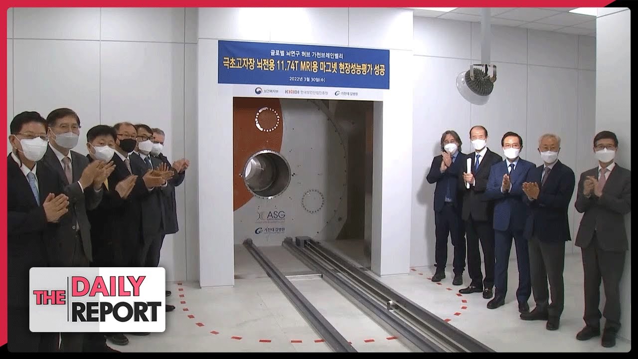 A new era of ultra-high-definition MRIs that show brain images 10,000 times clearer