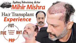 Must watch HAIR TRANSPLANT of ACTOR MIHIR | Sharing his Experience at Medispa India | Dr Suneet video
