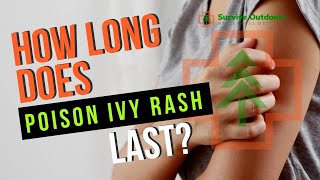 How Long Does the Poison Ivy Rash Last?