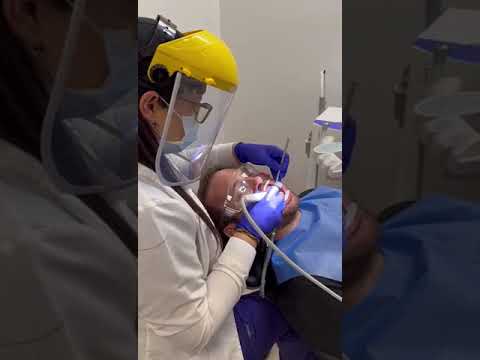 Limpieza dental Cartagena - Profilaxis Fanny Valera Smile Makeover Cartagena