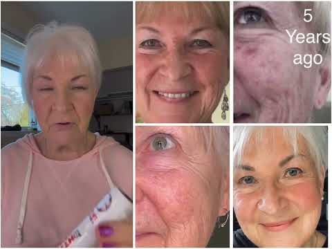 The Difference between 69 & 79 yrs. Don’t let anyone ever tell you you can’t wear pink at any age