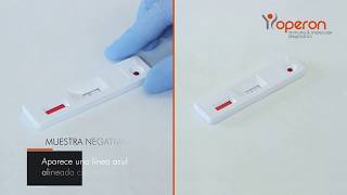 Test de celiaquía CD1WB – Detección de anticuerpos lgA/lgG/lgM en sangre humana