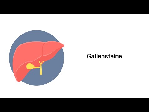 Gallensteine - Erkrankungen von Leber, Gallenwege und Pankreas