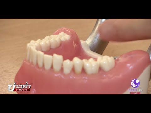 คลิกเพื่อดูคลิปวิดีโอ