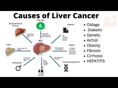 Hepatocellular carcinoma (HCC) DesGamma PIVKA II TEST