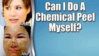 preview picture of video 'Chemical peel, Mordialloc: Can I do chemical peels myself?'