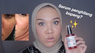 Download lagu Honest Review Snail True Cica On Sensitive Acne Prone Skin mp3