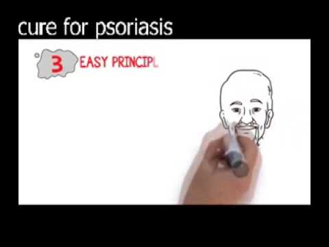 Cure For Psoriasis | Cure For Psoriasis in Homeopathy | Cure For Psoriasis in Scalp
