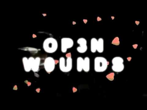 Cold Hart - Op3n W0unds