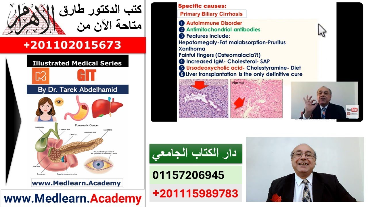 Liver Cirrhosis [2]   #internal_medicine #cme #medicaleducation #ecg #محاضرات_باطنة #medical