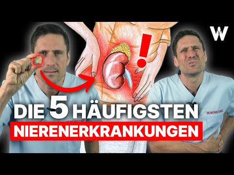 Nierenprobleme? Das sind die 5 häufigsten Nierenerkrankungen! Ursachen, Anzeichen und Therapie!