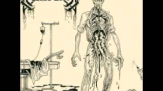 Mortician-Brutally Mutilated (DEMO 1990)