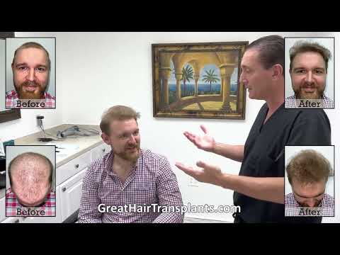 Dr  Brett Bolton Patient Mark MaxHarvest&trade; Plus

