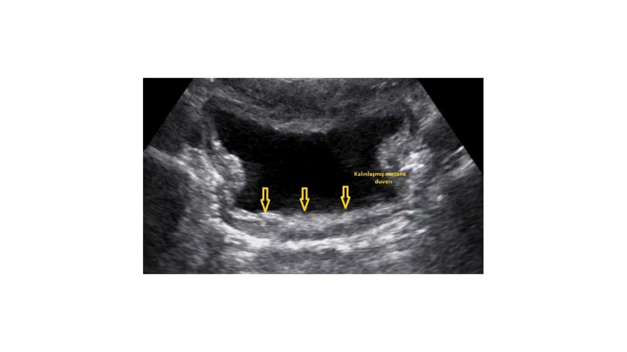 Şahver Melek Avcı Orhun-18