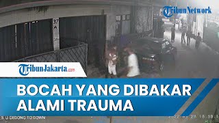 Bocah SD yang Dibakar Temannya Alami Trauma Takut Keluar Rumah, Ternyata Bukan Pertama Kali Dibully