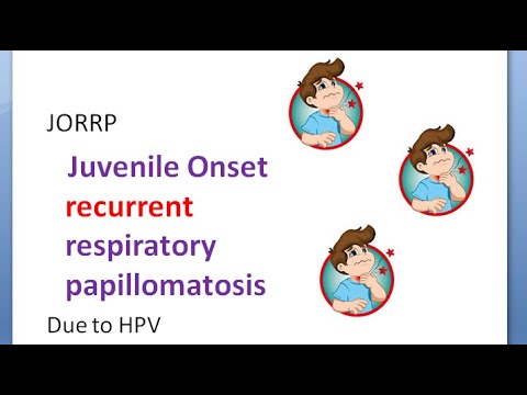 HPV (Humán Papilloma Vírus) fertőzés - Papillomavírus-kezelés