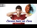 Excess Hair On Ear Hairy Ears Causes Tips For Removal Dr Nischal K Doctors Circle