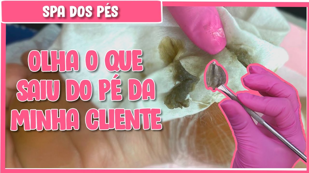 Spa dos Pés (Passo a Passo)