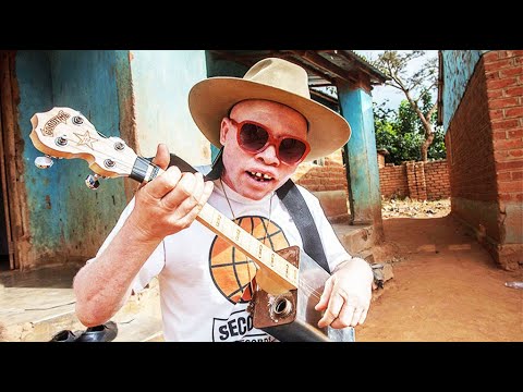 Lazarus, chanteur malawite adulé au service de la cause albinos | AFP News