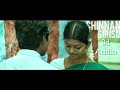 Chinna Siru Manasukkul 8D Song KungumaPoovumPonjumPuravum YuvanSongs 8daudio