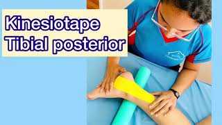 Aplicación de KINESIOTAPE  para Tendinitis  de TOBILLO 👈 👀- (Tibial posterior)
