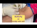 Blood collection through butterfly or scalp vein set