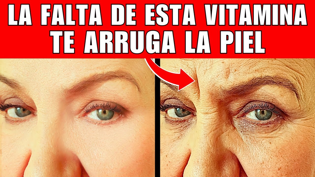 La VITAMINA que REVOLUCIONA tu PIEL, HUESOS, y CORAZÓN (CÓMO CONSEGUIRLA)