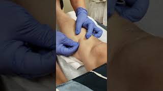 Master Tung Blood Letting by Esther Su