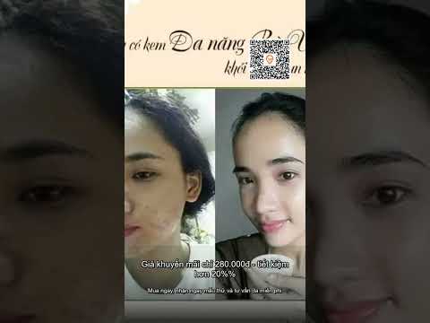 Kem đông y đa năng Bà Vân chính hãng dùng bôi da dành cho mọi lứa tuổi