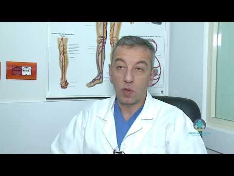 Sëmundjet e arterieve koronare - mbroshendetin.al