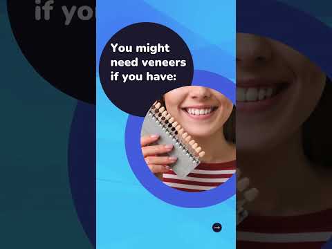 Dental Veneers