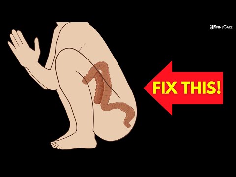 How to Instantly Relieve Constipation (POOP NOW!)